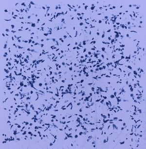 Bombardment_DRRR_01